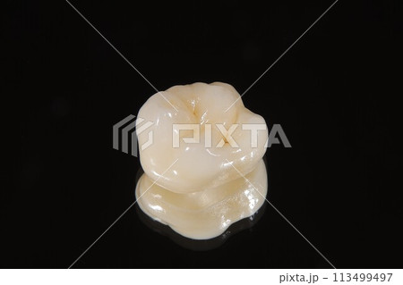 オールセラミッククラウン 113499497