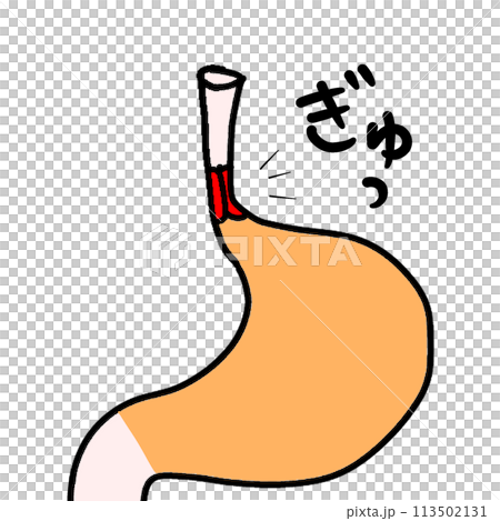 反流性食道炎的故事 反流性食道炎的故事 113502131