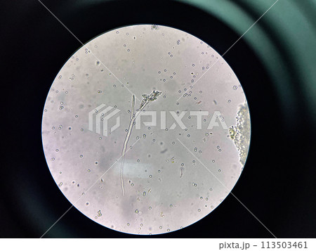 Budding yeast cell in nature. Budding yeast cell in nature. 113503461