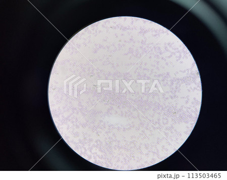 Budding yeast cell in nature. 113503465