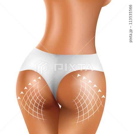 Perfect sexy firm buttock of healthy women in white bikini 113535566