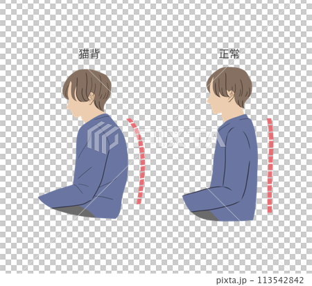 Illustration set of men with hunchback and correct posture Illustration set of men with hunchback and correct posture 113542842