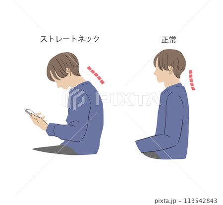 ストレートネックと正しい姿勢の男性のイラストセット ストレートネックと正しい姿勢の男性のイラストセット 113542843