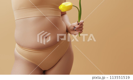 Body imperfections. Real human skin without 113551519