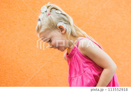 Child head with cochlear implant hearing aid. Hearing aid and medicine innovating technology and diversity concept. Copy space 113552918