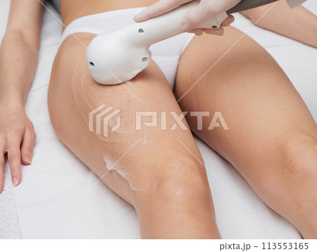 Beautician Removing Hair Of Young Woman body 113553165