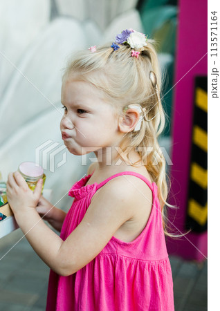 Funny child with cochlear implant walks outdoor. Hearing aid and medicine innovating technology concept. Diversity and inclusion. 113571164