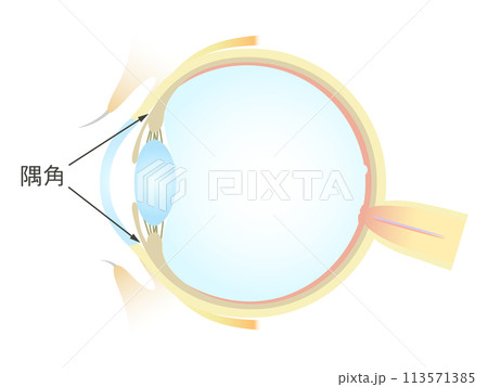 眼の垂直断面図 隅角 113571385