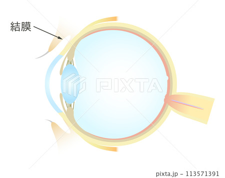 眼の垂直断面図 結膜 113571391