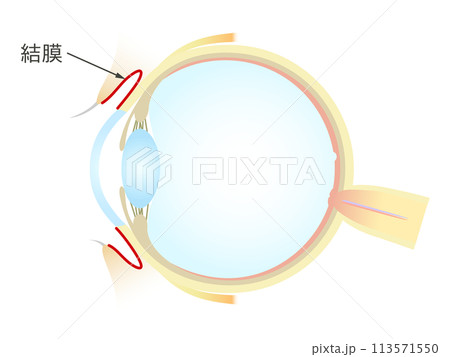 眼の垂直断面図 結膜 113571550