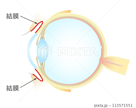 眼の垂直断面図 結膜 眼の垂直断面図 結膜 113571551