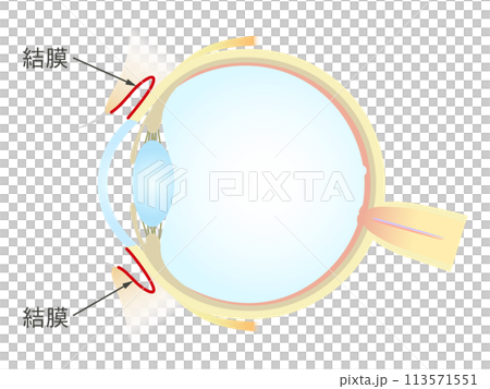 眼の垂直断面図 結膜 眼の垂直断面図 結膜 113571551