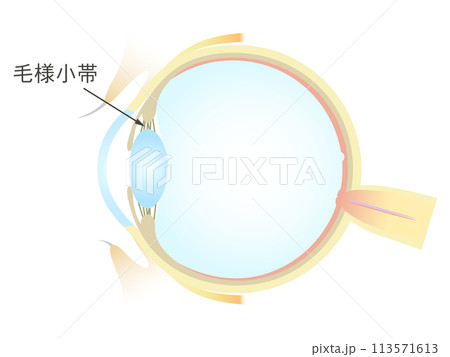 眼の垂直断面図 毛様小体 眼の垂直断面図 毛様小体 113571613