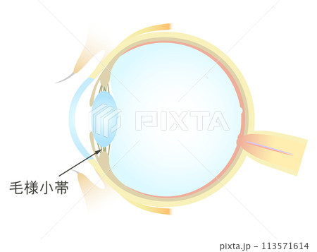 眼の垂直断面図 毛様小体 眼の垂直断面図 毛様小体 113571614
