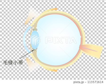眼の垂直断面図 毛様小体 眼の垂直断面図 毛様小体 113571614