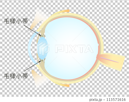 眼の垂直断面図 毛様小体 113571616