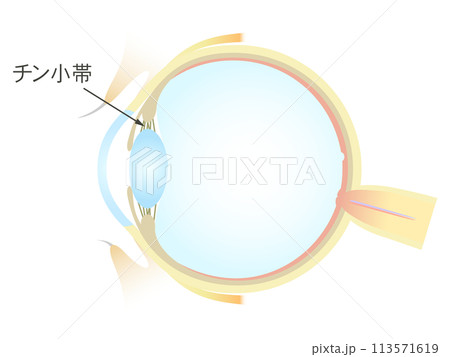 眼の垂直断面図 チン小体 113571619