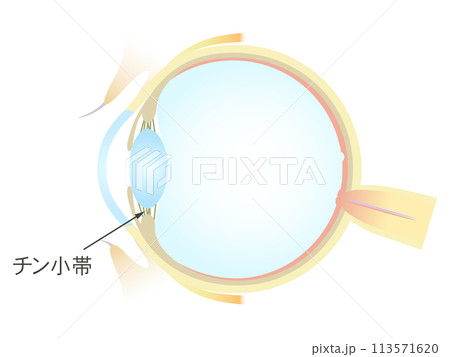 眼の垂直断面図 チン小体 113571620