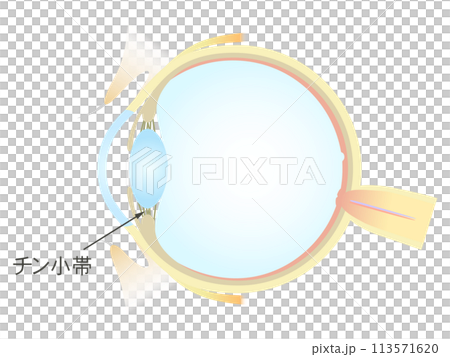 眼の垂直断面図 チン小体 113571620