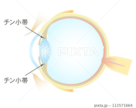 眼の垂直断面図 チン小帯 113571664