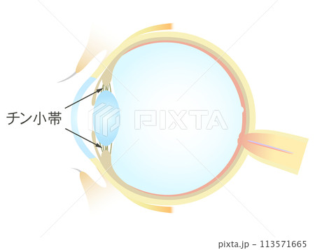 眼の垂直断面図 チン小帯 眼の垂直断面図 チン小帯 113571665