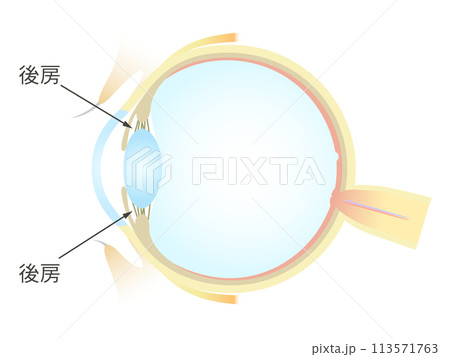 眼の垂直断面図 後房 眼の垂直断面図 後房 113571763