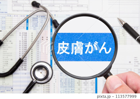 皮膚がん 医療イメージ 皮膚がん 医療イメージ 113577999