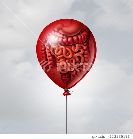 Abdominal Bloating 113586151