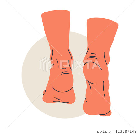 Walking naked feet. Barefoot legs back view,...のイラスト素材 [113587148] - PIXTA