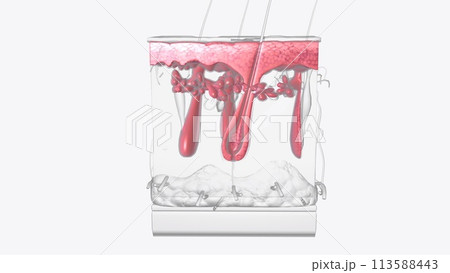 The epidermis is the most superficial layer of the skin 113588443