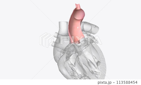 The aortic valve is one of four heart valves and is the final one encountered by oxygenated blood as it leaves the heart The aortic valve is one of four heart valves and is the final one encountered by oxygenated blood as it leaves the heart 113588454