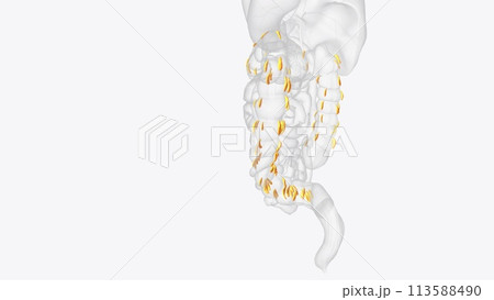 Epiploic appendages are normal outpouchings of peritoneal fat on the anti-mesenteric surface of the colon Epiploic appendages are normal outpouchings of peritoneal fat on the anti-mesenteric surface of the colon 113588490