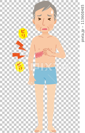 Man suffering from shingles and pain Symptoms 113608485