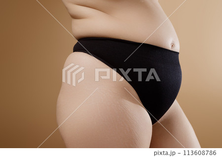 Unaltered , natural skin and body with stretch 113608786