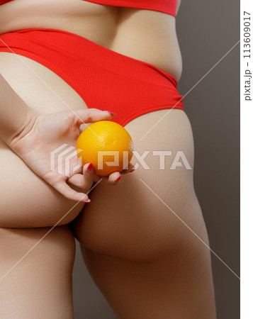 Stretch marks on female legs. A woman's hand holds Stretch marks on female legs. A woman's hand holds 113609017