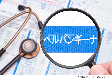 ヘルパンギーナ　医療イメージ 113617167