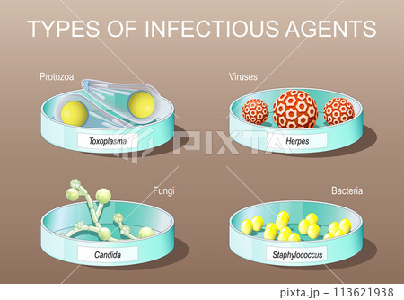 Petri dishes with Candida albicans, herpes viruses, staphylococcus, and toxoplasma 113621938