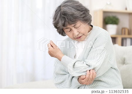 肘が痛いシニア女性 肘痛 関節痛 肘が痛いシニア女性 肘痛 関節痛 113632535