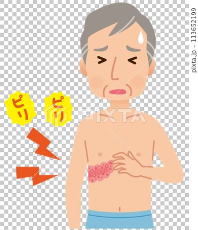 帯状疱疹ができて痛みがある男性　症状 113652199