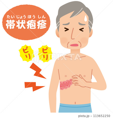 帯状疱疹ができて痛みがある男性　症状 113652250
