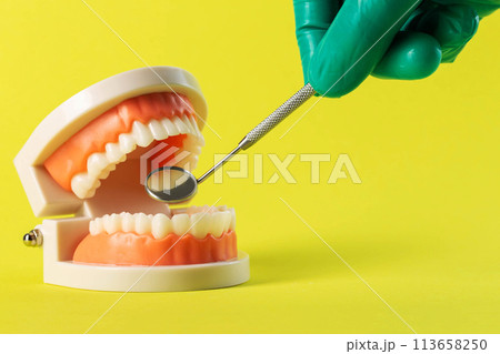 The hand of a dentist doctor in a green medical glove holds a dental mirror in his hand near a mock-up of a dental jaw on a yellow background. Concept of wisdom teeth removal, gum inflammation, molar The hand of a dentist doctor in a green medical glove holds a dental mirror in his hand near a mock-up of a dental jaw on a yellow background. Concept of wisdom teeth removal, gum inflammation, molar 113658250