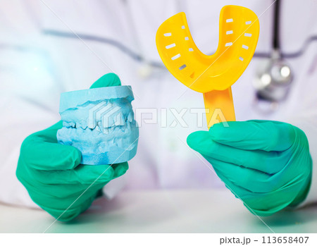 Doctor dentist holds a yellow spoon and an impression of the patient's jaw in green medical gloves. The concept of making dentures and dental crowns based on a patient s impression in a dental 113658407