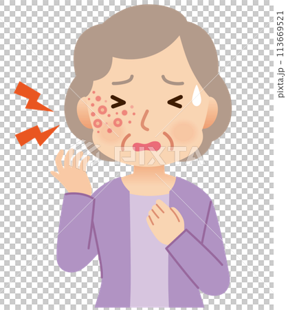 Elderly woman suffering from pain due to shingles Symptoms 113669521