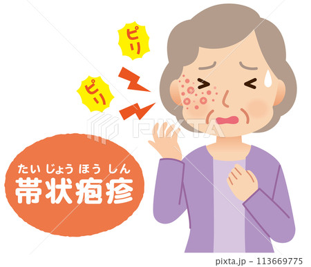 帯状疱疹ができて痛みがある高齢者女性 症状 帯状疱疹ができて痛みがある高齢者女性 症状 113669775