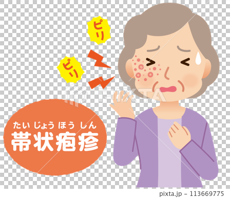 帯状疱疹ができて痛みがある高齢者女性 症状 帯状疱疹ができて痛みがある高齢者女性 症状 113669775