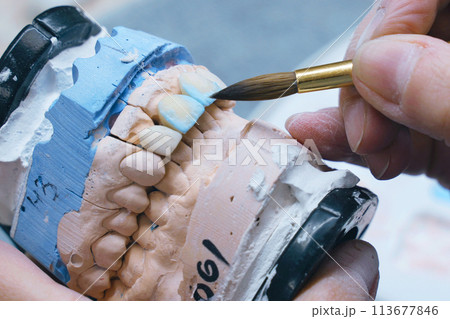 A dental technician paints a denture with a brush. A dental technician paints a denture with a brush. 113677846