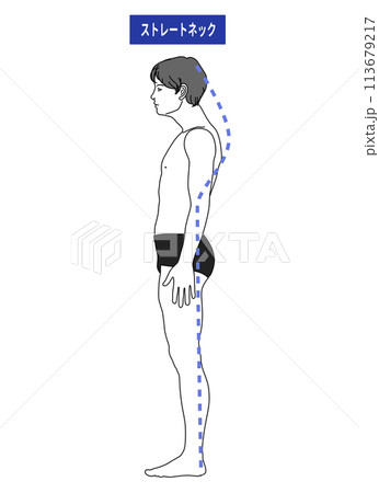 ストレートネック スマホ首で首が前に傾いた悪い姿勢 立ち方の日本人男性のイラスト 全身横向き 横顔 ストレートネック スマホ首で首が前に傾いた悪い姿勢 立ち方の日本人男性のイラスト 全身横向き 横顔 113679217
