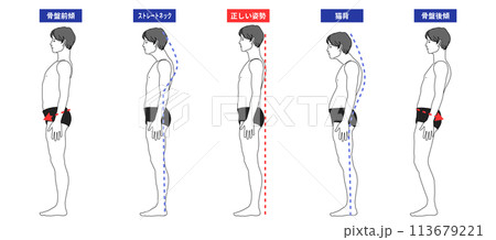 姿勢改善 姿勢矯正 猫背 ストレートネック 骨盤後傾 骨盤前傾の日本人男性のイラスト 全身横向き 姿勢改善 姿勢矯正 猫背 ストレートネック 骨盤後傾 骨盤前傾の日本人男性のイラスト 全身横向き 113679221