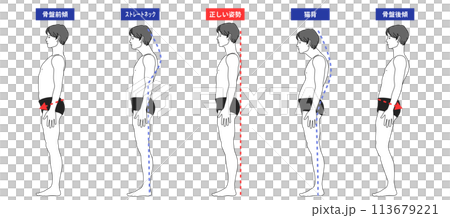 良い姿勢と姿勢でストレートネック 猫背 骨盤後傾 骨盤前傾になっている全身横向きの男性のイラスト 113679221