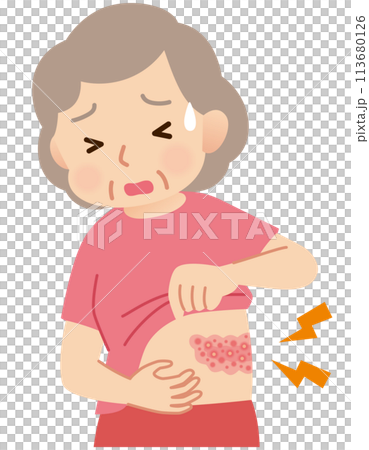 Elderly woman suffering from pain due to shingles Symptoms Elderly woman suffering from pain due to shingles Symptoms 113680126